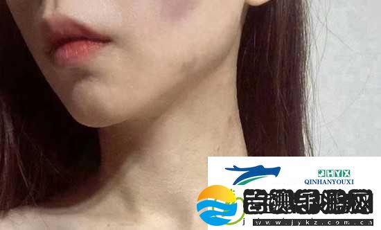 红雅典娜LIYA死了吗