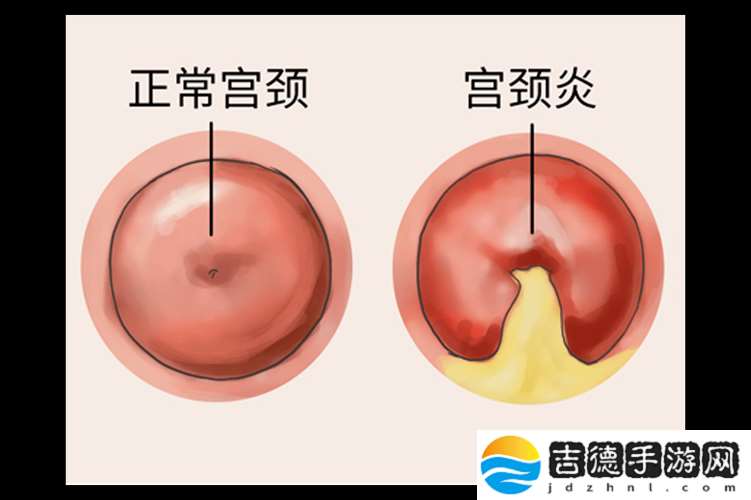 啪啪顶到最里面流血情况是否常见及相关探讨