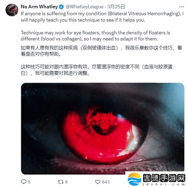 《英雄联盟》主播No Arm Whatley：失明挑战极限，自创技巧重回大师